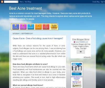  Best Acne Treatment