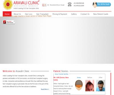 Aravali Hair transplant Institute