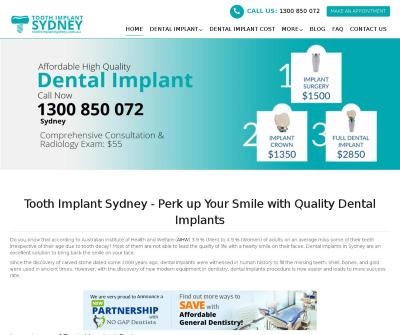 The Worthwhile Investment: Understanding the Cost of Dental Implants in Sydney