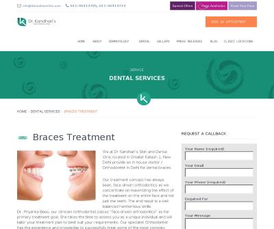Dental Braces Treatment in Greater Kailash, South Delhi, India-Drkandhariclinic