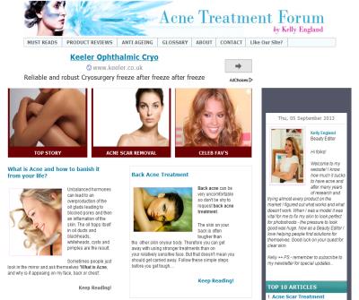 Back Acne | Treatment | Pimples | Acne Treatment Forum