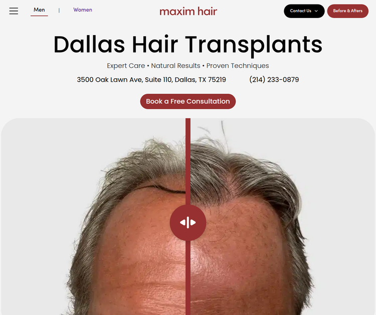 Maxim Hair Restoration & Transplants - Dallas