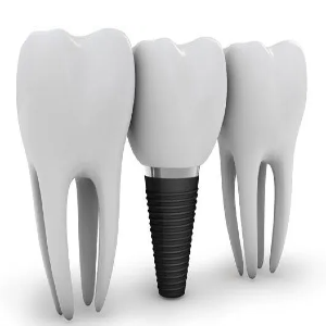 Dental Implant Affordable Implant Dentistry Services Melbourne-http://www.dentalimplantmelbourne.com.au