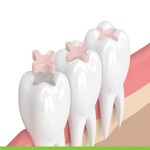 Serenity Smiles Dental | General Dentistry, Cosmetic Dentistry, Orthodontic-https://www.serenitysmilesdental.com.au/