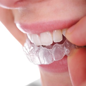 No Gap Dentists-https://www.affordabledentist.sydney