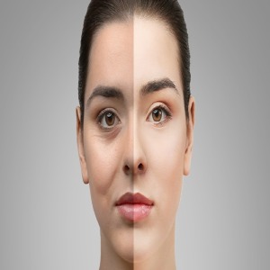 Microneedling oakville