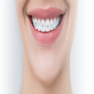 Orthodontics Blacktown NSW